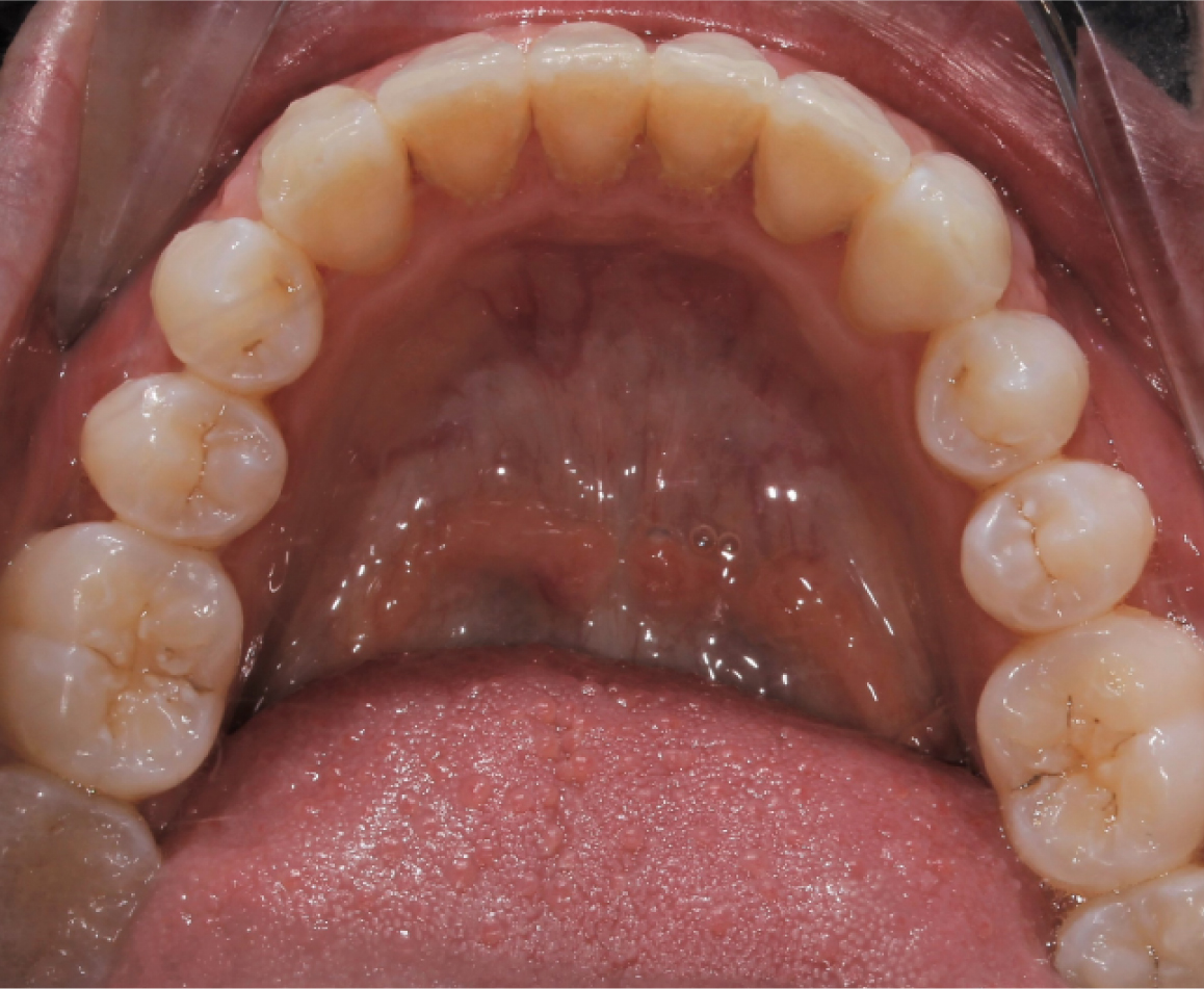 Before image