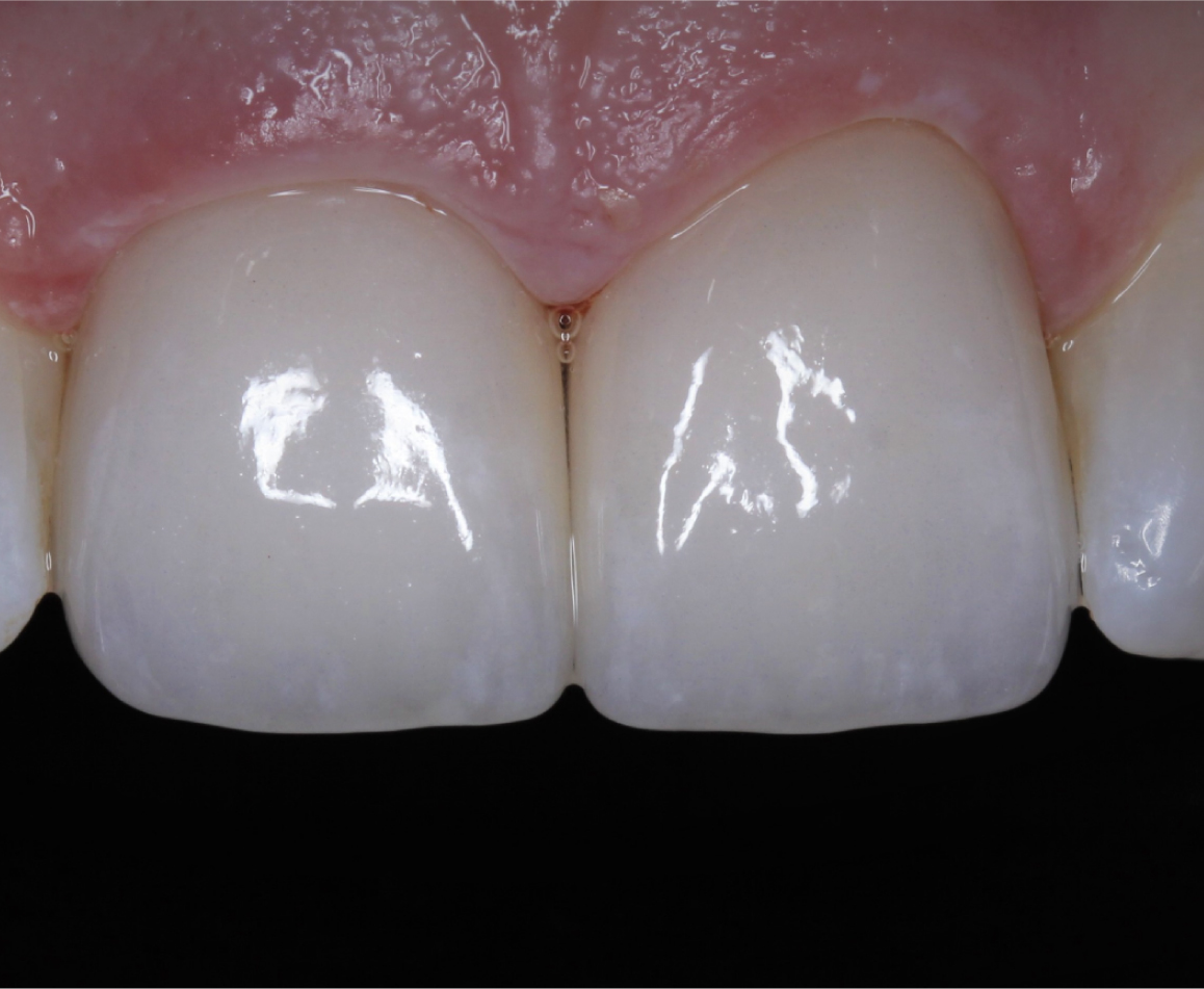 After image