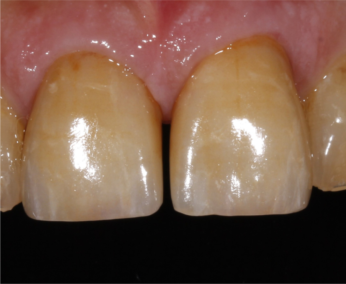 After image