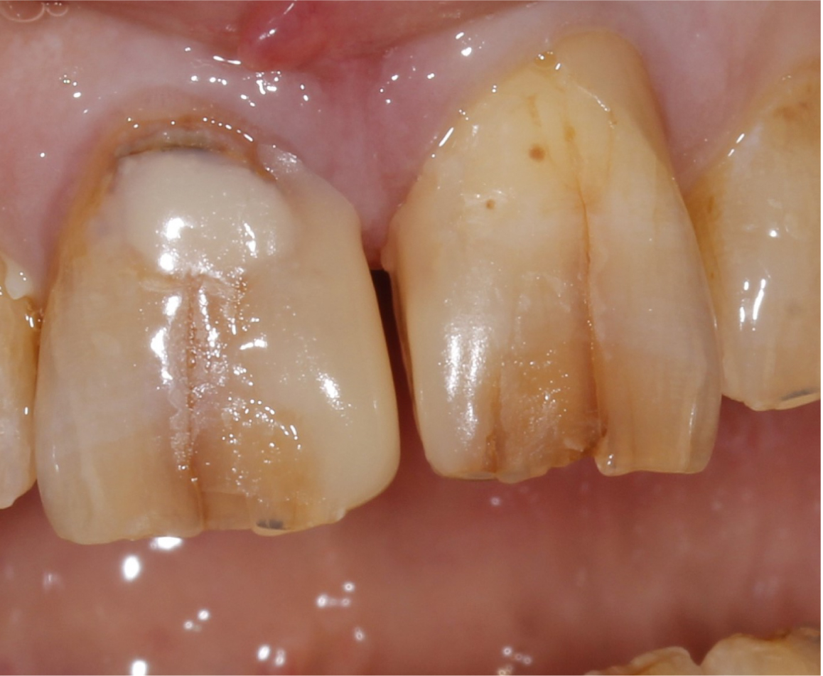 Before image