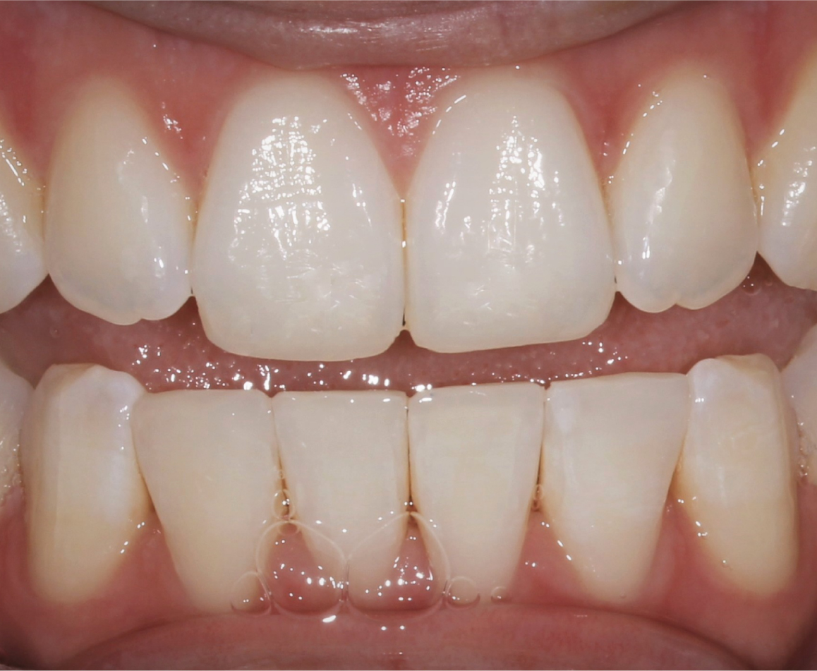 After image