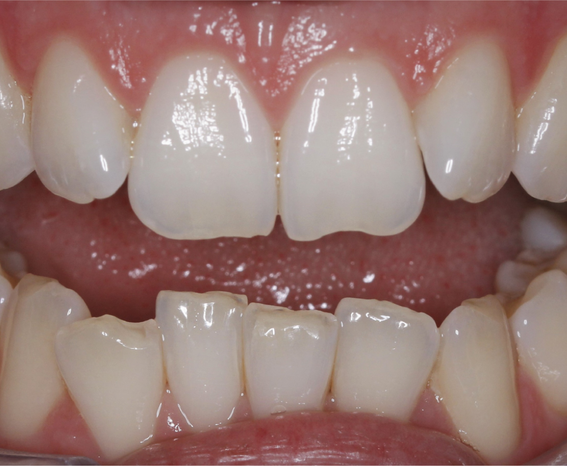 Before image