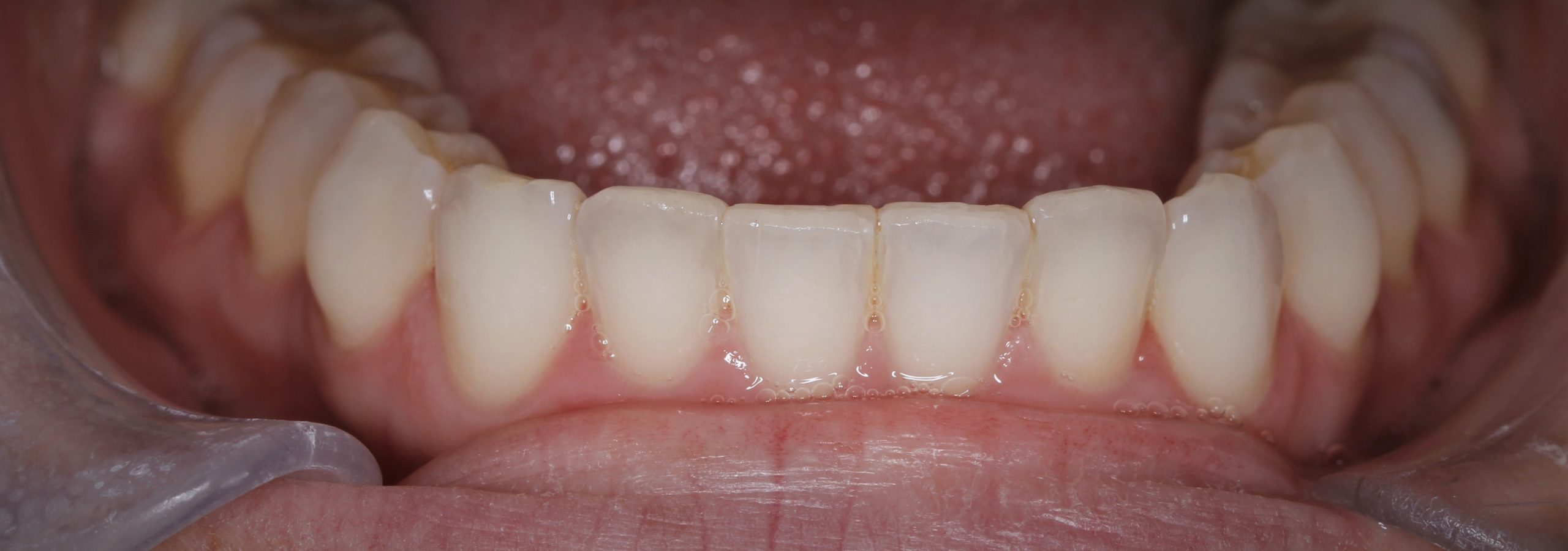 Before image